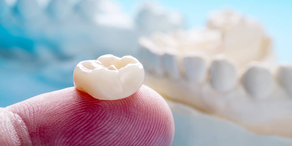 Can Fillings Look Like Your Natural Teeth? - TruCare Dentistry